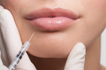 The art and science of dermal fillers of hyaluronic acid