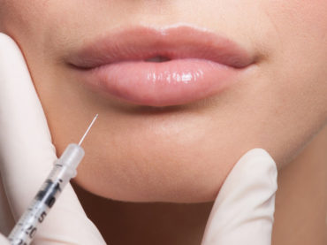 The art and science of dermal fillers of hyaluronic acid