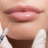 The art and science of dermal fillers of hyaluronic acid