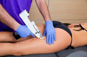 Intradermal mesotherapy effective in reducing cellulite